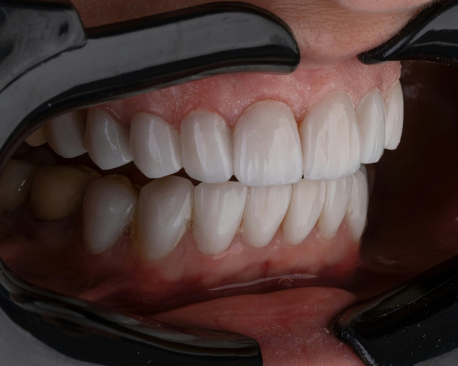 Para qué sirven los dientes