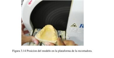 Para qué sirve el alginate Para qué sirve el alginate