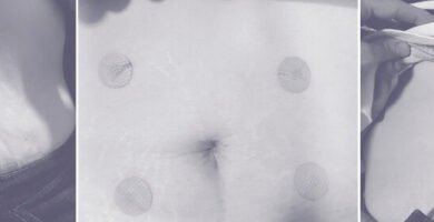 Para qué sirve el biomag Para qué sirve el biomag