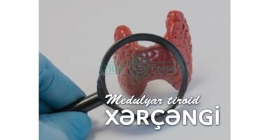 Para qué sirve el latanoprost Para qué sirve el latanoprost